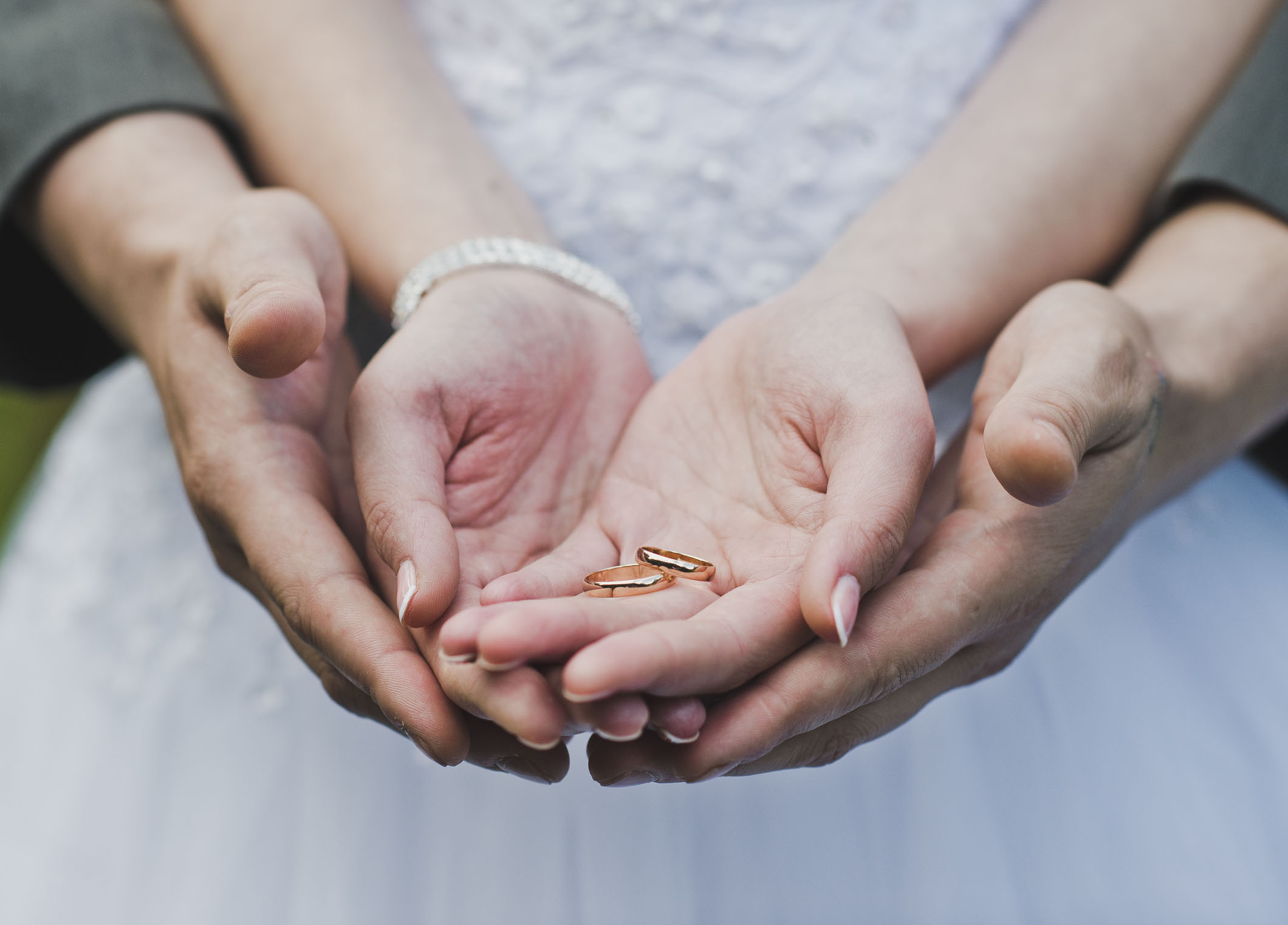 The arms of the palms with rings.